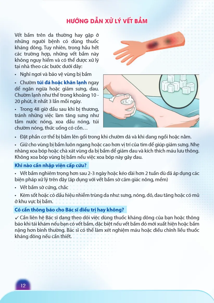 10 - Tu van khang dong khang vitamin K (tai ban) - Noi tim mach_14.webp